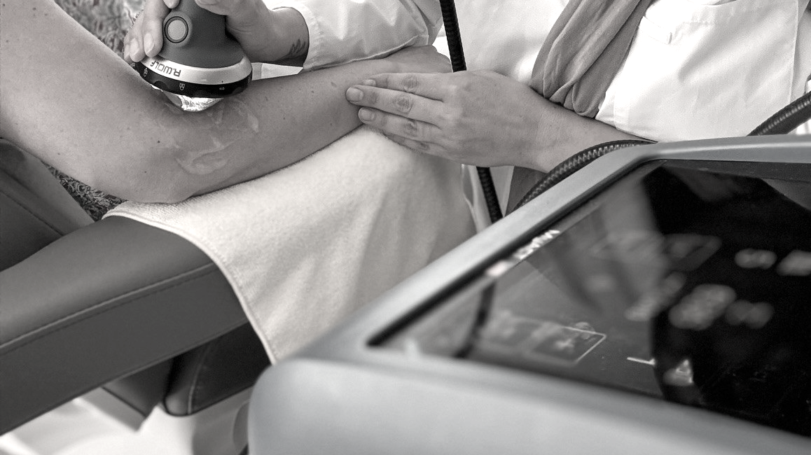 Shockwave Therapy Minnetonka: ESWT for Tendon Pain